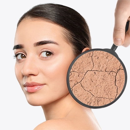 Dry & Dehydrated Skin