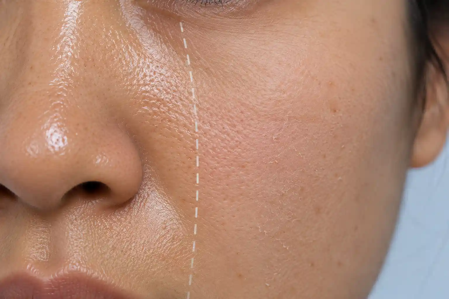 Combination Skin